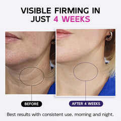 GOOSURE crema cuello firme textura sedosa para absorción rápida