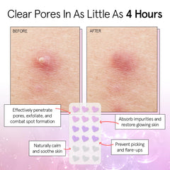 parche corazón rosa Grace & Stella para piel sensible, cuidado suave