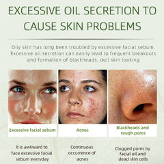 Grospe Acne Removing Cream texture appears smooth and lightweight for everyday use