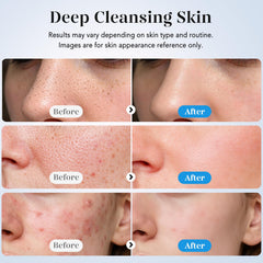 GUGUG Skin Scrubber ion mode aids product absorption.