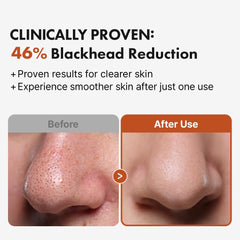 Hanskin BHA Pore Cleansing Oil removing makeup and impurities with gentle cleansing action.