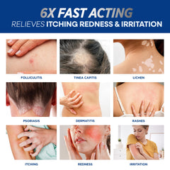 Hermon Folliculitis Cream being applied to skin for scalp, face, and body care.