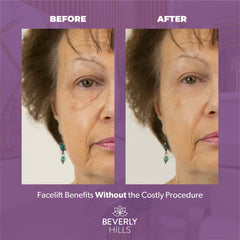 BEVERLY HILLS Instant Facelift Eye Serum – Anti-Aging Treatment for Dark Circles, Puffiness & Fine Lines | 30mL