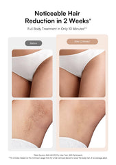 INIA HAUTE Pro body mode for efficient full-body hair reduction.