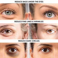 Instaderm under-eye close-up shows smoother skin around the eye area.