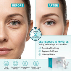Instantly Ageless dark circles cream jar targets under-eye shadows for brighter skin.