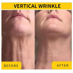 Irismistx crema cuello, contorno más firme para cuello y escote
