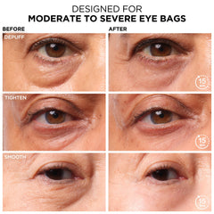 Bye Bye Under Eye Bags close-up shows the blurring film effect.