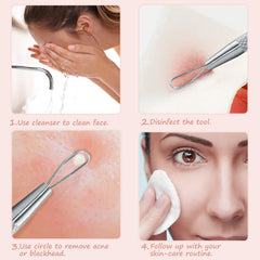 jaxiria stainless steel pimple popper closeup highlighting durable handle