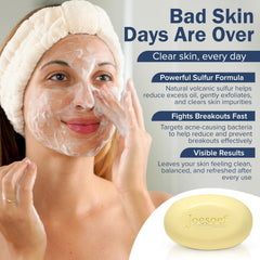 Joesoef Anti-Acne Soap dermatologist-developed formulation supports gentle cleansing.