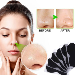 JWBVCTCR bamboo charcoal formula strips absorb oil and impurities.
