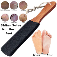 Kinepi Foot Scrubber dual-sided stone for targeted exfoliation
