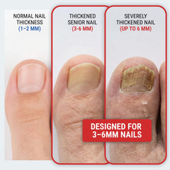 KLIPP Toenail Clippers curved blades deliver smooth cuts for curved nails.