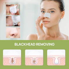 LANBENA Blackhead Removal Kit box signaling a complete facial cleansing ritual.
