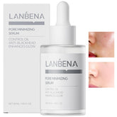 LANBENA Minimizador de poros en bote de 30 ml para reducir poros y control de grasa.