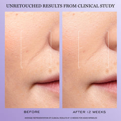 Lancôme Rénergie H.C.F. Triple Serum lightweight, fast-absorbing texture on skin.