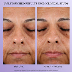 Lancôme Rénergie H.P.N. bottle highlights hyaluronic acid hydration effect.