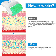 LATME Ice Roller neck and chest use for smoothing and circulation boost.