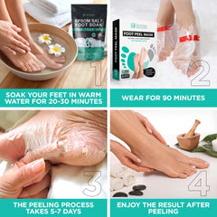 Lavinso exfoliating socks applied to feet beginning the peel process.