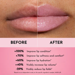 LAWLESS Forget the Filler Daisy Girl on lips demonstrating subtle fullness and smooth lines.