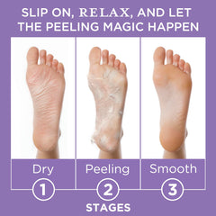 Lee Beauty Mandelic and Lactic Acid exfoliation on feet.