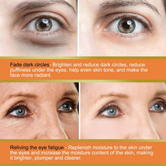 LOYOTICE Contorno de ojos con vitamina C reduce la apariencia de ojeras