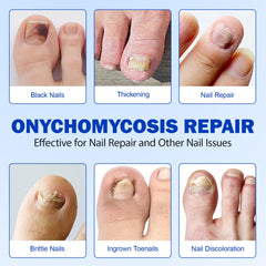 LTQXGT nail repair glue is designed for easy, durable bonding on nails.