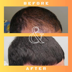 Science-backed Mane Regain formula close-up highlights RU58841-based solution.