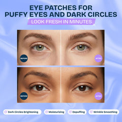 Parches OJOS MAREE refrescantes con sensación fría para ojeras.