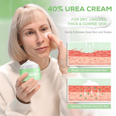 Mariayu Urea Cream 40% on feet — softens cracked heels gently