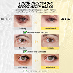 Maskiss hyaluronic acid eye masks hydrate and soften fine lines.