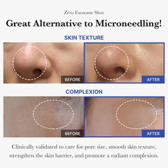 Medicube Exosome Shot absorbcion-mejorada: hidratación profunda visible