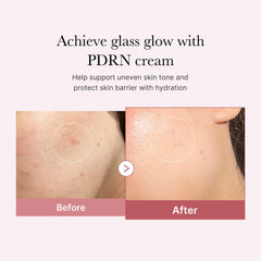 Efecto brillo en la piel con Medicube PDRN Rosa Crema para tono uniforme