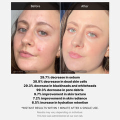 Protección de ingredientes calmantes para piel sensible durante exfoliación.