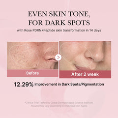 Medicube Rose PDRN Toner, etiqueta rosa, facilita una preparación suave de la piel.