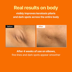MEDITHERAPY Serum uso diario en cuerpo, mejora textura en codos y rodillas.