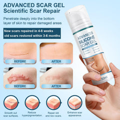 Mitgary Advanced Scar Gel texture close-up highlights smooth, non-greasy finish.