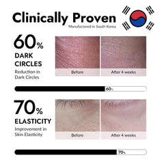 MIZON snail slime eye patch nourishes delicate skin around the eyes.