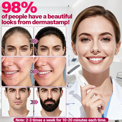 MONESAO Derma Stamp with replacement heads for tailored sessions.