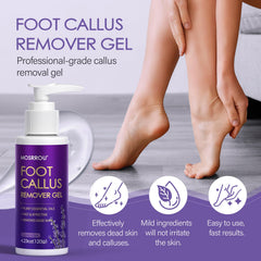 MOSRROU dual-sided callus remover ready for smoothing rough skin