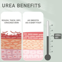 Mouriven Urea Cream 40% on knees and elbows softening rough areas