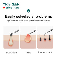 MR.GREEN precision tips engineered in Germany support tight grip and precise placement.