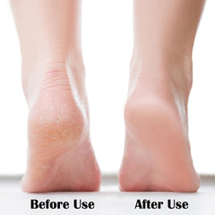 MR LION Nano Foot File with ergonomic grip provides comfortable control