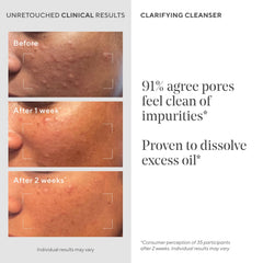 Murad Acne Control Clarifying Cleanser gel texture applied on skin.