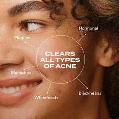 Murad Biome-Balancing Acne Serum texture swatch demonstrates light, non-greasy finish.