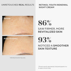 Murad Niacinamide and Picolinamide barrier support close-up