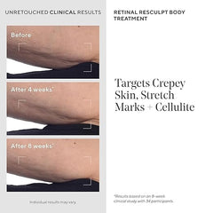 Murad Retinal ReSculpt crepey skin area with smooth, hydrated appearance