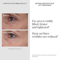 Murad Retinal ReSculpt application close-up demonstrating precise eyelid use