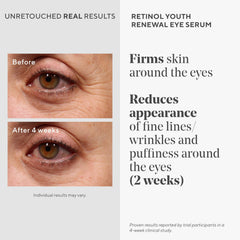 Murad Retinol Youth Renewal Eye Serum applied to under-eye area for smoother look.