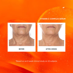 Naturium Vitamin C Complex Serum 2oz packaging displayed on shelf